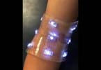 Smart Bandages