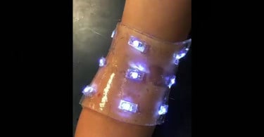 Smart Bandages