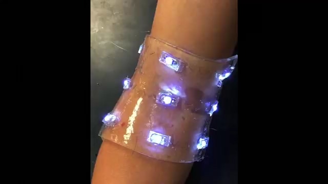 Smart Bandages