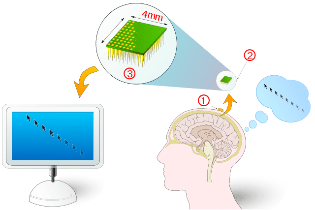 Components of BCI